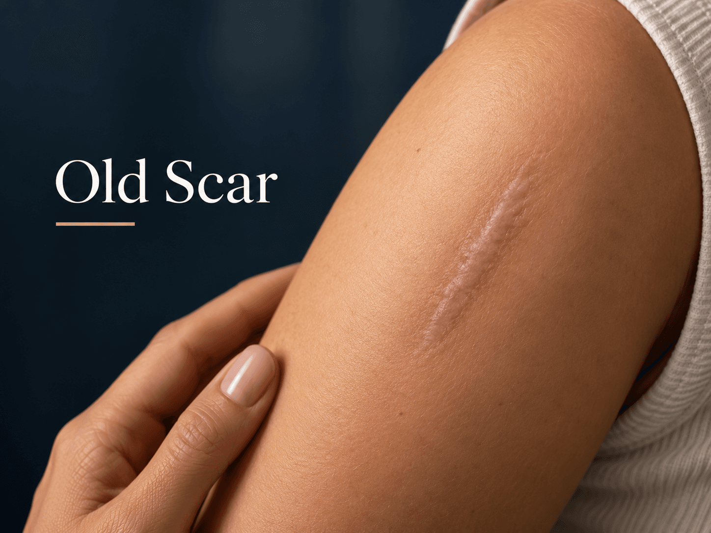 Old Scar